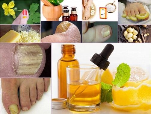 rimedi popolari per il trattamento dei funghi sulle unghie dei piedi